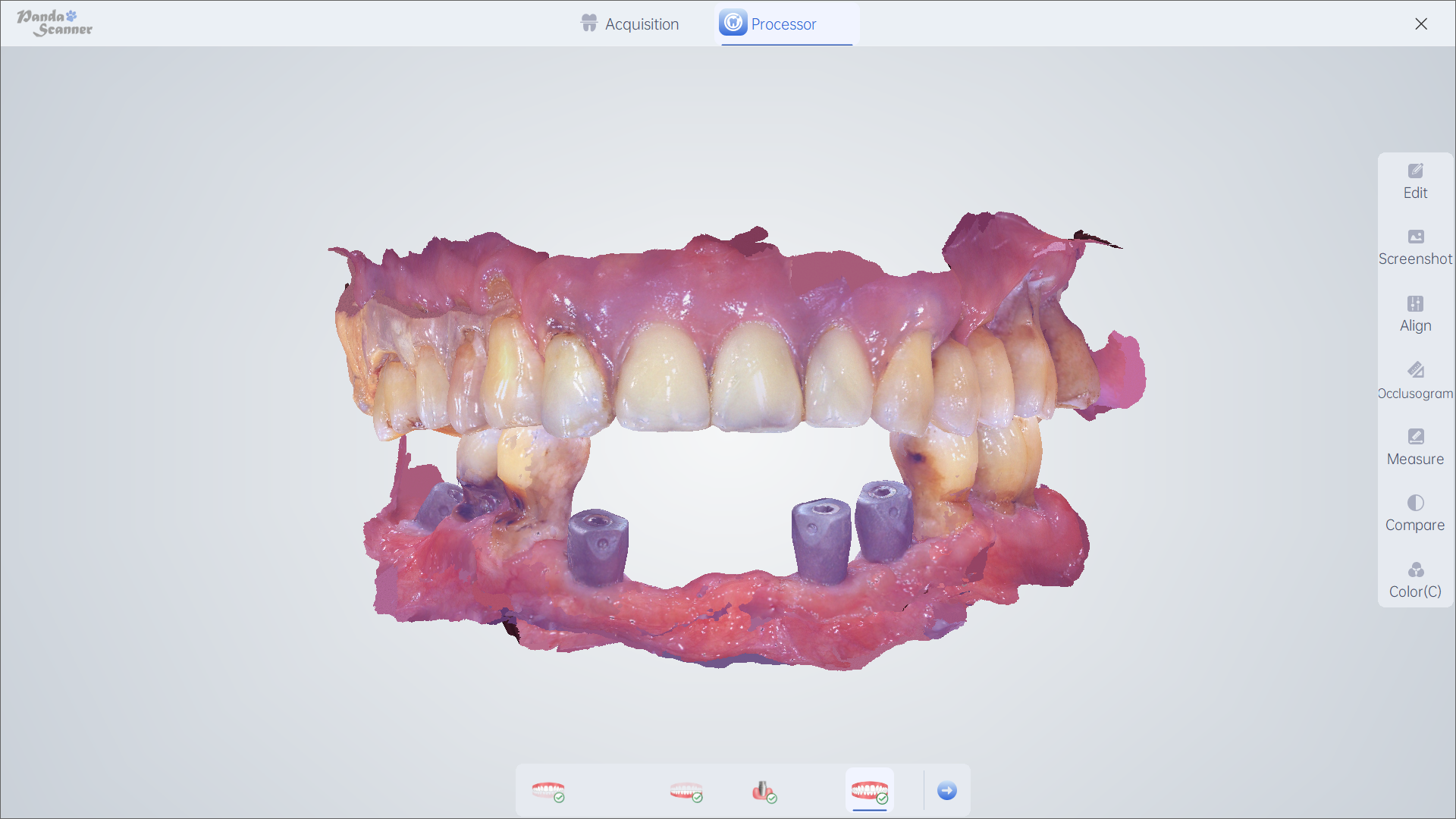 Implantat 2