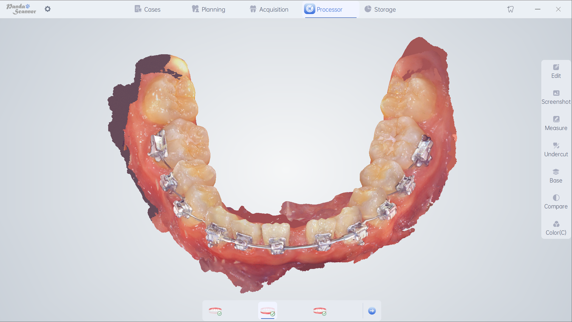 I-Orthodontics 1