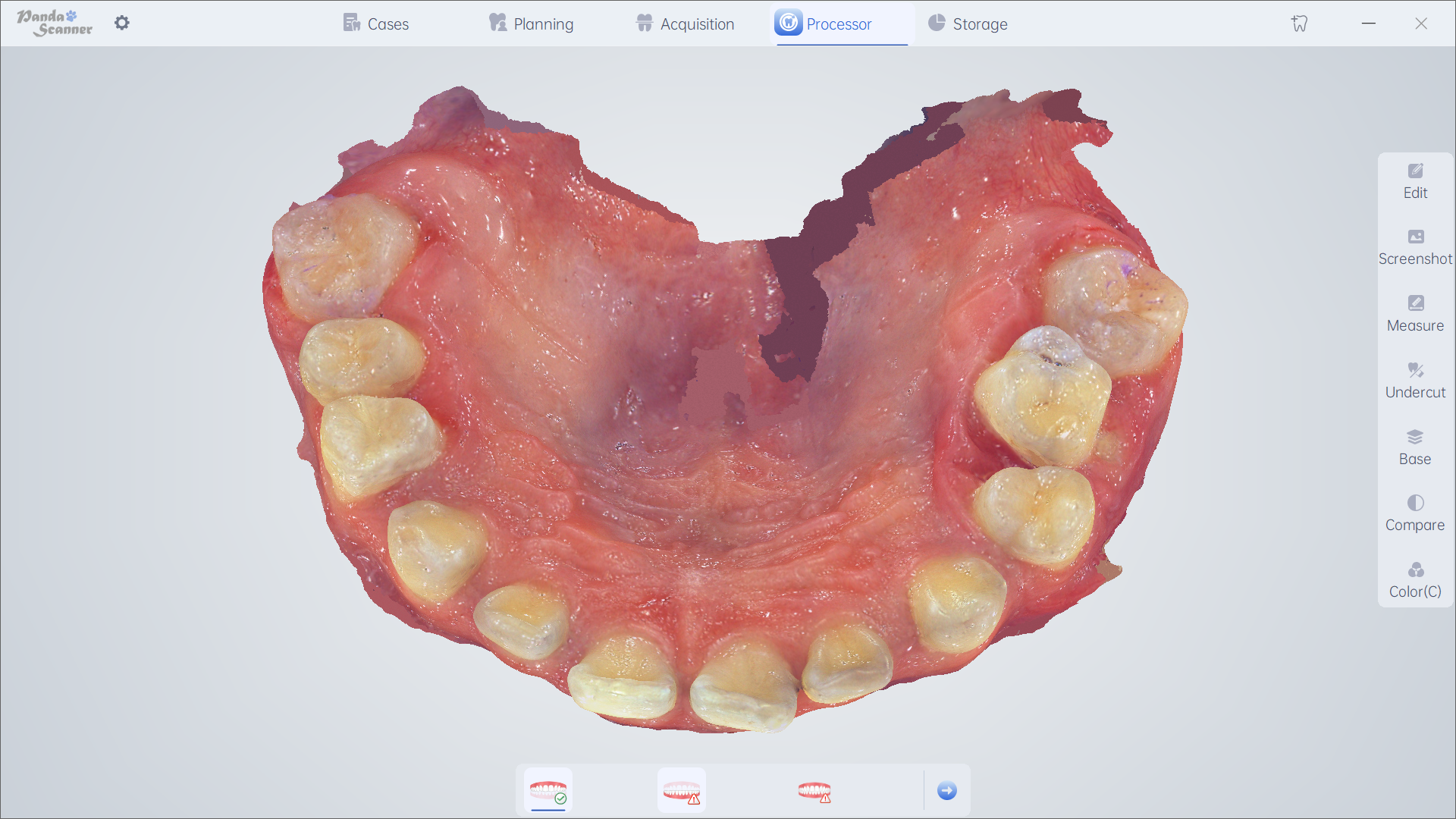 Orthodontics 2