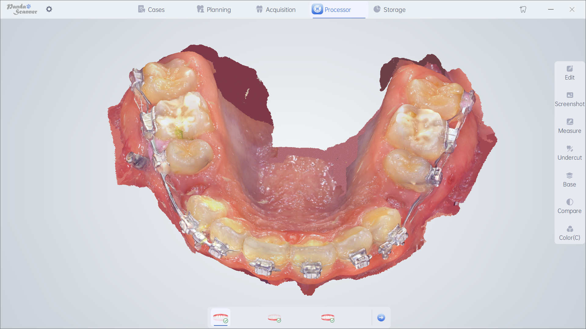 Orthodontics 3