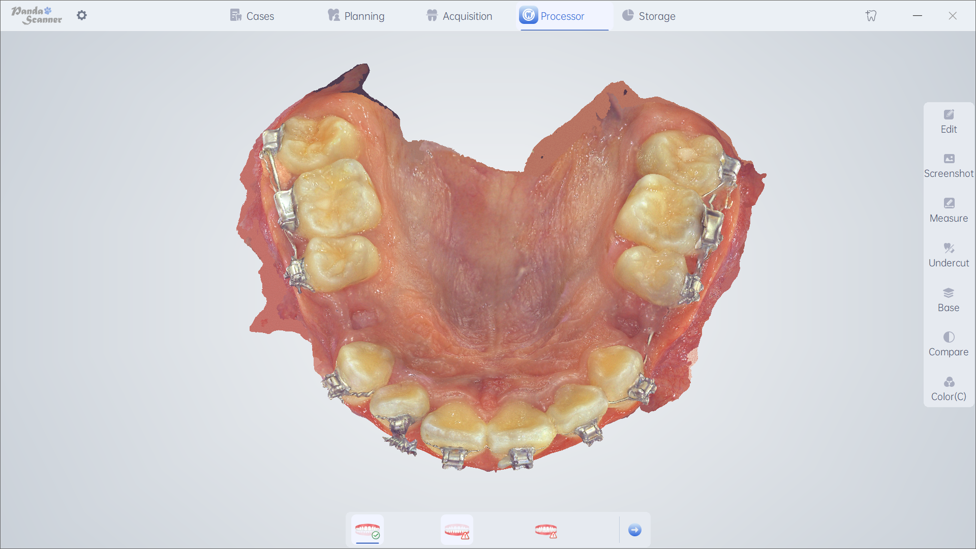 I-Orthodontics 4