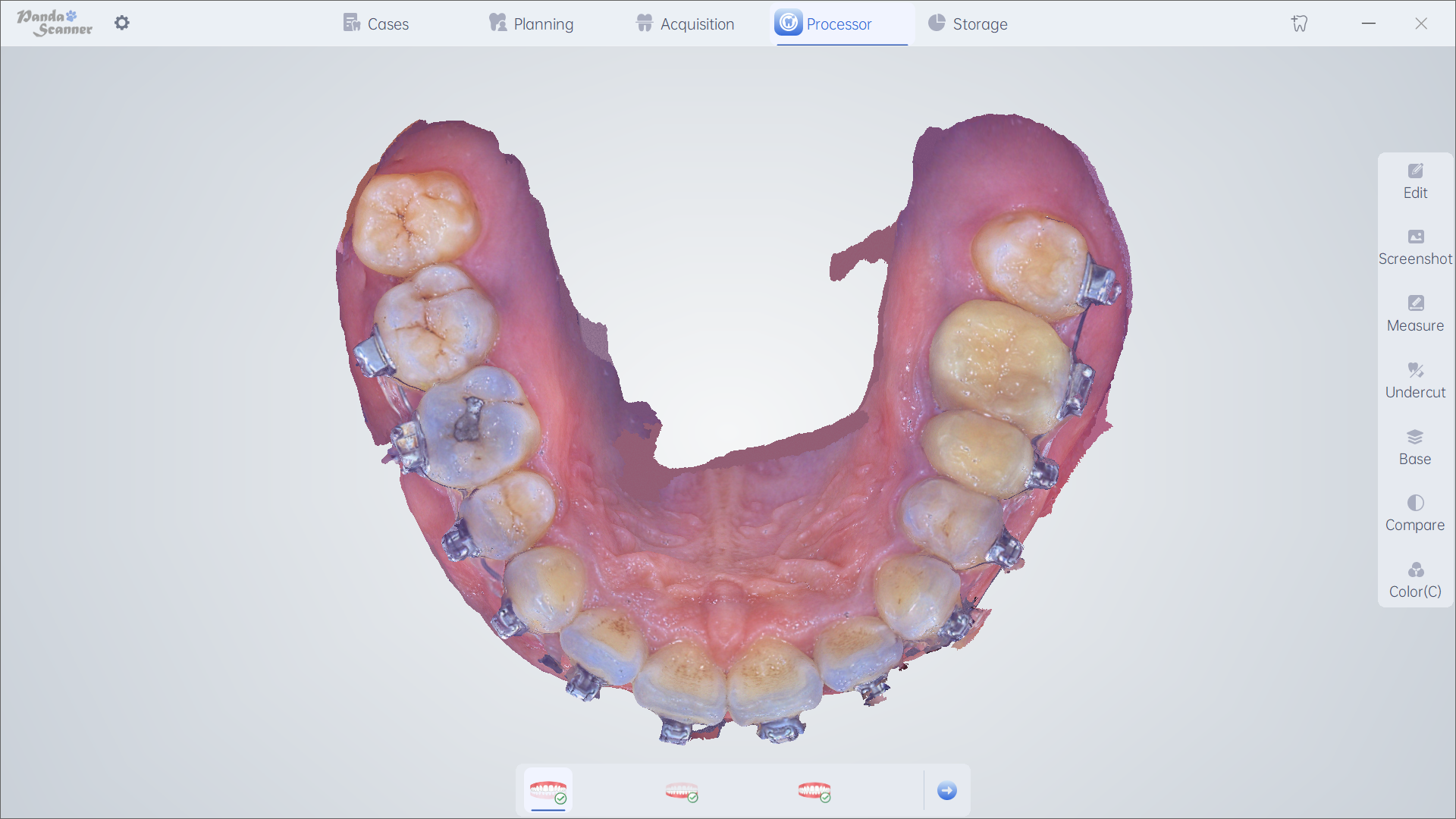 Orthodontics 5