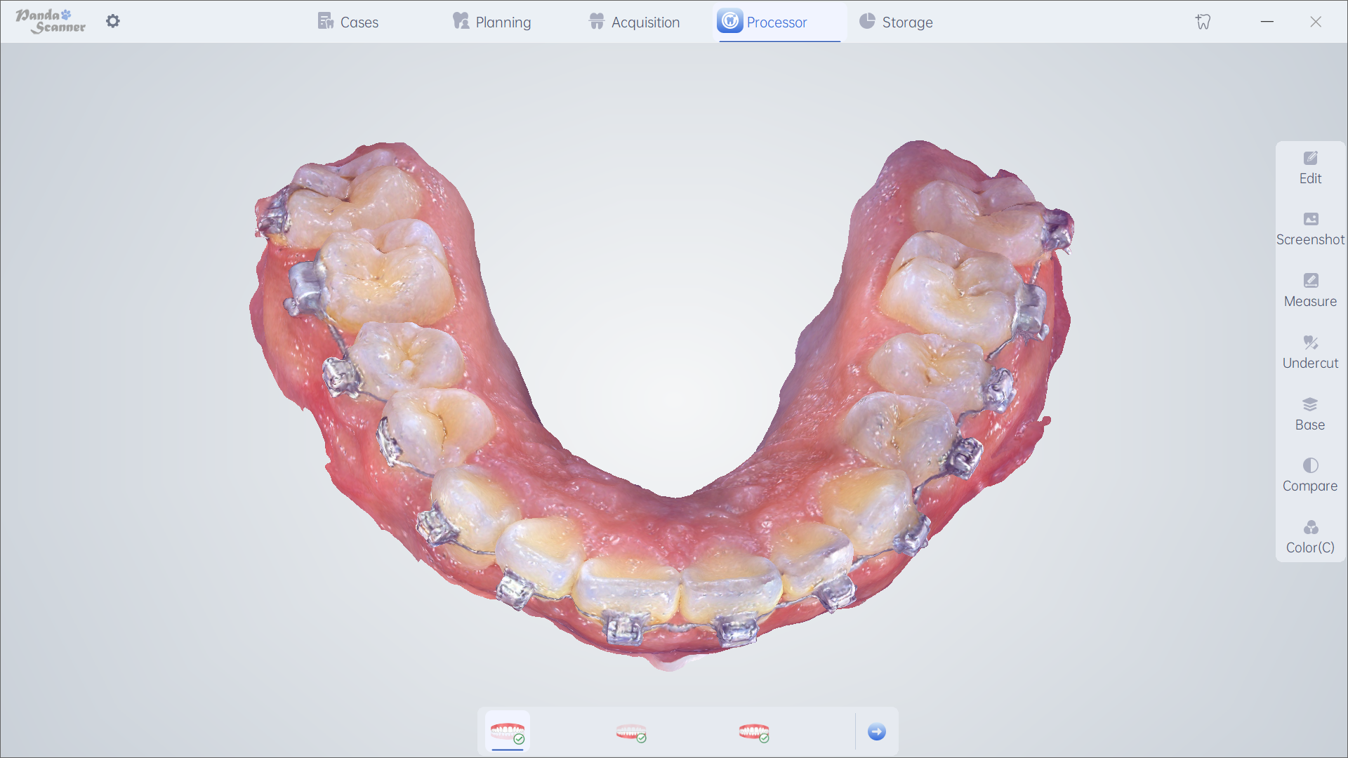 Orthodontics 6