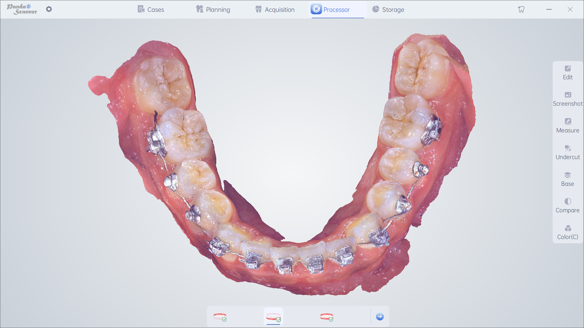 Orthodontics 7